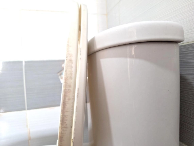 Sau một thời gian sử dụng, bề mặt nắp bồn cầu nhà chị Hoài xuất hiện nhiều vết hoen bẩn, khó vệ sinh. Ảnh: Nhân vật cung cấp
